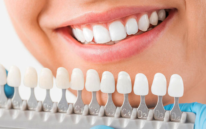  Імплантація зубів необхідна складова щасливої ​​людини